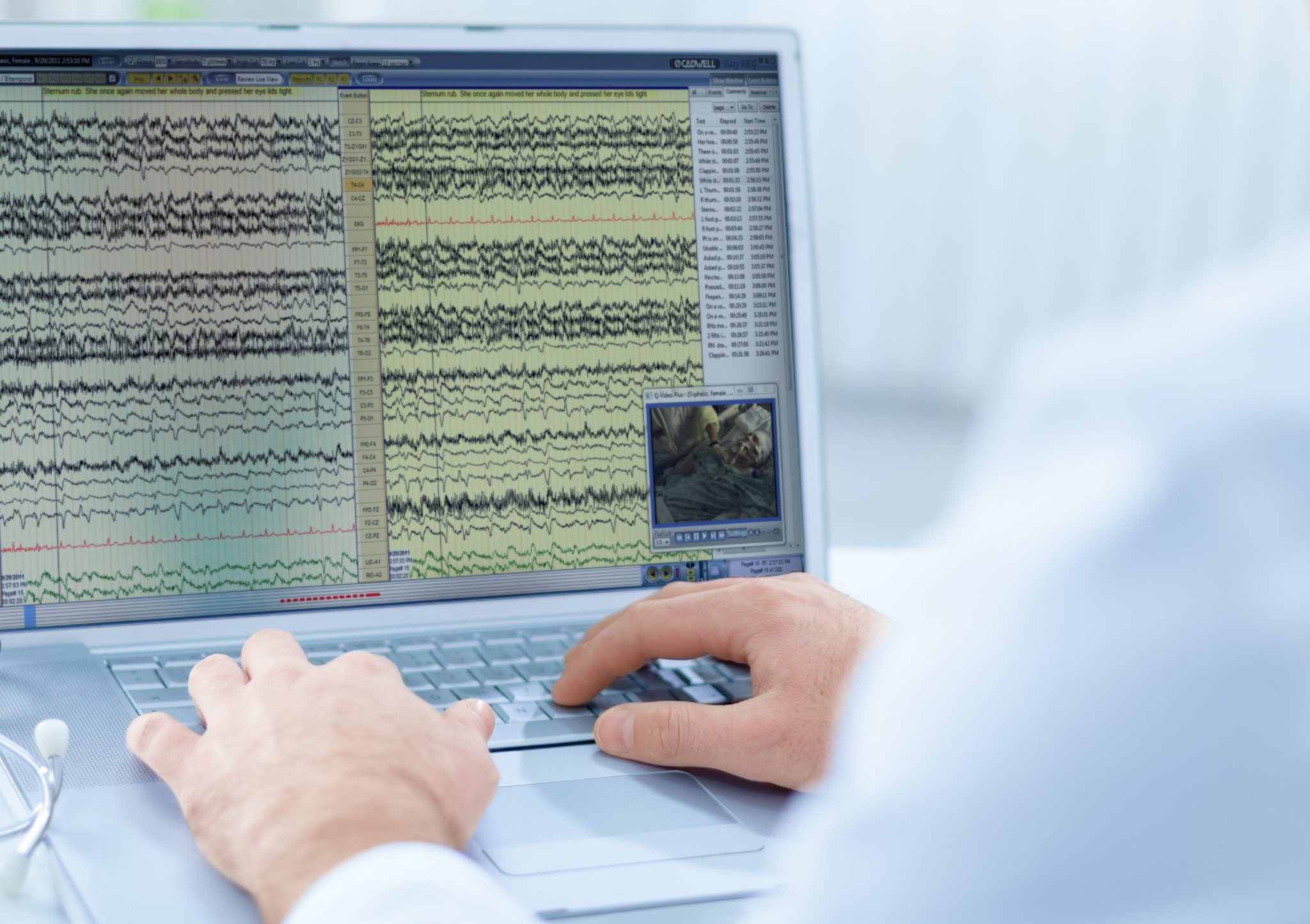 Electrodo de Copa Neuroline Ambu desechable/ TP/ cable 1.5 mt. / Set 10 unds. 