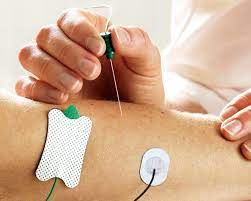 Electrodo Tierra AMBU / 150 cm. / TP / Caja 25 uds.