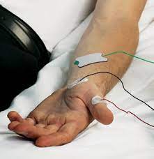 Electrodo Tierra AMBU / 150 cm. / TP / Caja 25 uds.