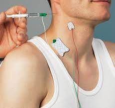 Electrodo Tierra AMBU / 150 cm. / TP / Caja 25 uds.