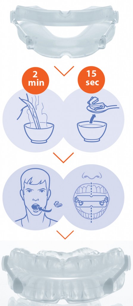 ONiRiS AntiRonquidos - Ortesis Avance Mandibular