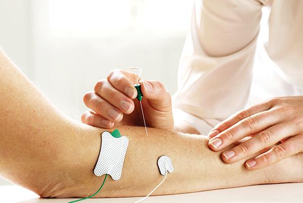 Aguja Monopolar / AMBU Neuroline / 25x0.36mm / 28G / Gris Oscuro / Caja 40 uds.